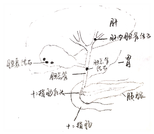 胆囊结石胆总管结石教你分清楚